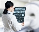 Novel approach to predict outcomes in COVID-19 patients