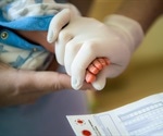 What is a PKU Test?