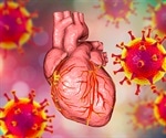Israeli Pfizer COVID vaccine/myocarditis study, 136 cases out of 5 million
