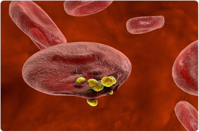 Malaria