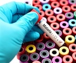 Purdue researcher receives $1.38 million to fight against drug-resistant malaria in developing countries