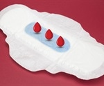 Study finds menstrual bleeding changes after SARS-CoV-2 vaccination