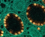Evidence that mild and even asymptomatic SARS-CoV-2 infection can lead to sustained immune activation