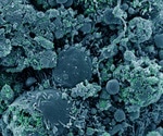 SARS-CoV-2 reinfection and the natural immune response