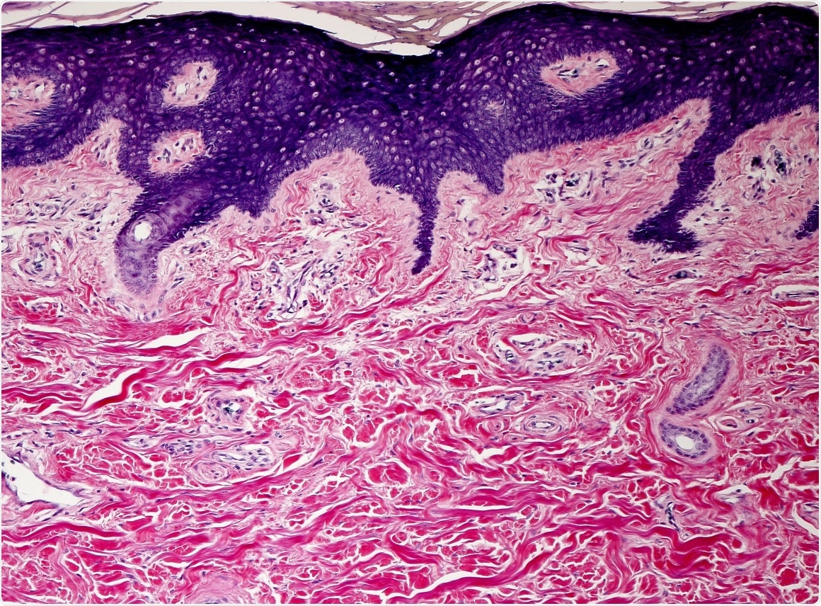 AMSBIO offers an extensive collection of normal and disease state FFPE tissue blocks
