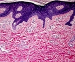 AMSBIO offers an extensive collection of normal and disease state FFPE tissue blocks