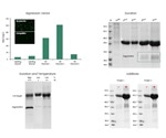 The challenges faced in recombinant protein expression