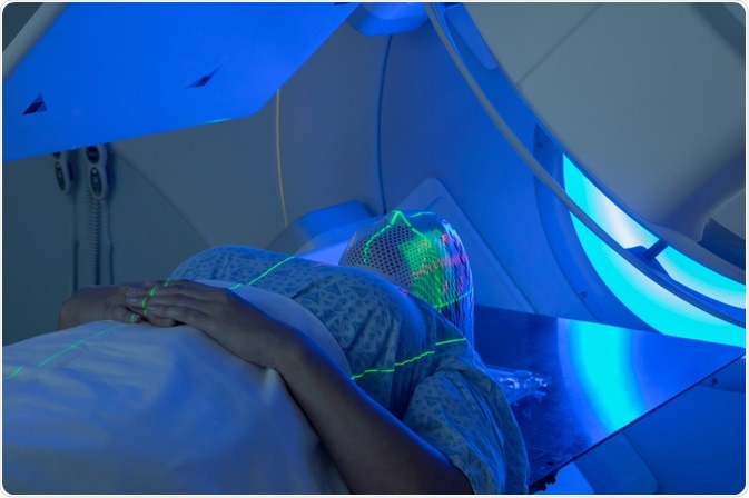 Radiotherapy Radiotherapy