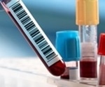 How the new In-Vitro Diagnostics Regulations are affecting the life sciences landscape