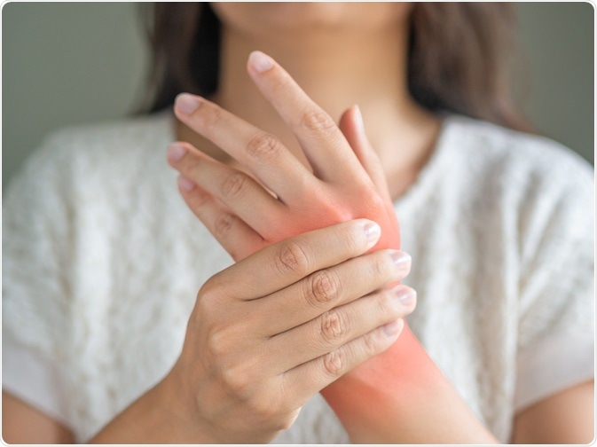 Infectious Arthritis Concept Infectious Arthritis Concept