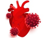 Current understanding of the link between COVID-19 and cardiovascular disease