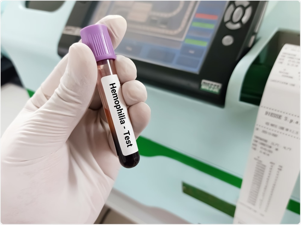 Hemophilia Test Hemophilia Test