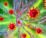 Potential link between SARS-CoV-2 infection and secondary occurrence of anti-NMDAR encephalitis