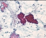 Advancing our understanding of T cells to improve cancer therapies