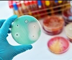 Antibiotic vs Antimicrobial Resistance