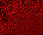 Olympus scanR high-content screening station v. 3.3 adds improved deep-learning capabilities for fast, efficient image analysis