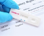 Comparison of point-of-care SARS-CoV-2 diagnostic kits