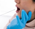 SARS-CoV-2 Delta saliva viral load 15 times that of the wild type
