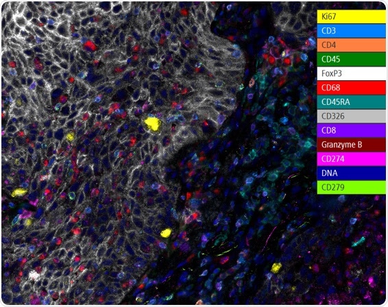 Canopy Biosciences launches the first of a series of targeted assay kits for ChipCytometry Fluorescent image of human lung cancer FFPE sample with 13 protein biomarkers illuminated using the Spatial Immune Profiling Kit for ChipCytometry.