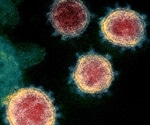 Study identifies immune profile of people with severe COVID-19