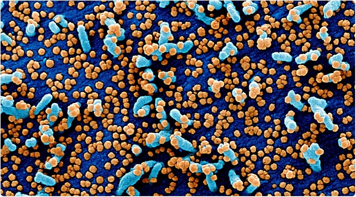 Study: Nanotraps for the containment and clearance of SARS-CoV-2. Image Credit: NIAID / Flickr