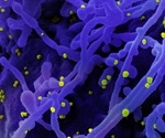 Oxysterol derivatives show powerful antiviral activity against SARS-CoV-2 in vitro