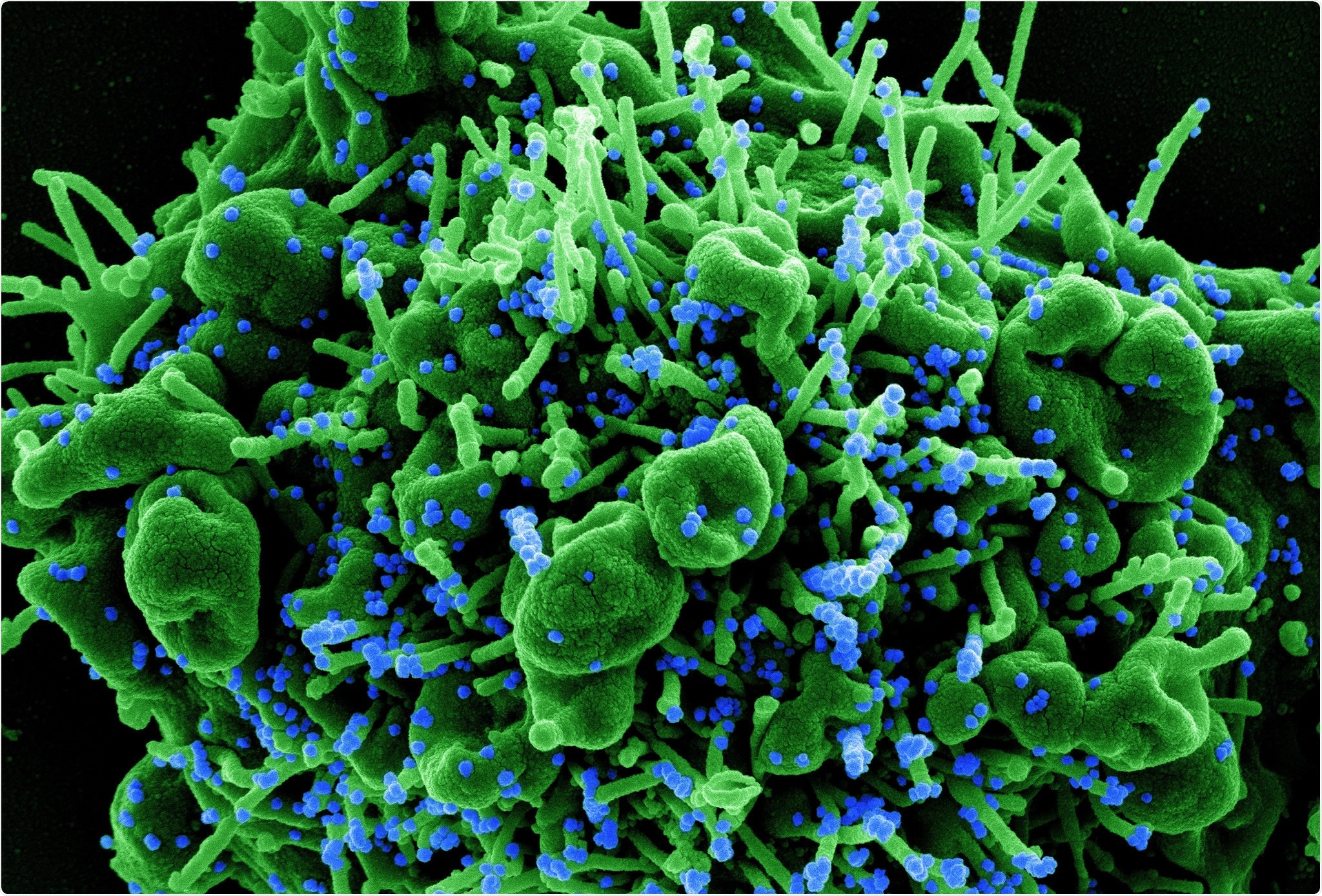 Study: L18F substrain of SARS-CoV-2 VOC-202012/01 is rapidly spreading in England. Image Credit: NIAID