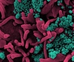 Corticosteroid receptor inhibitor shows anti-SARS-CoV-2 activity in vivo