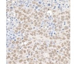 Reagent Validation Via ENCODE: A Free, Publicly Funded Source
