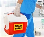 Metabolomics in Organ Transplantation