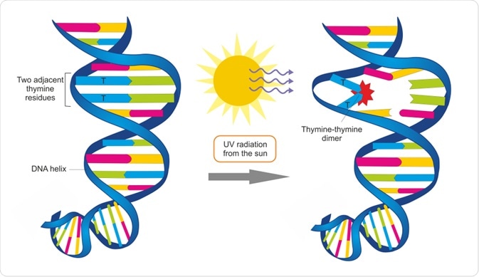 UV radiation