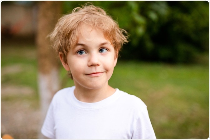 strabismus