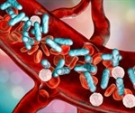 Sepsis Diagnosis