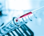 What is Pharmacodynamics?