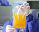 Plasma Donation and COVID-19