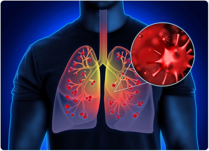 sars-cov-2 lungs