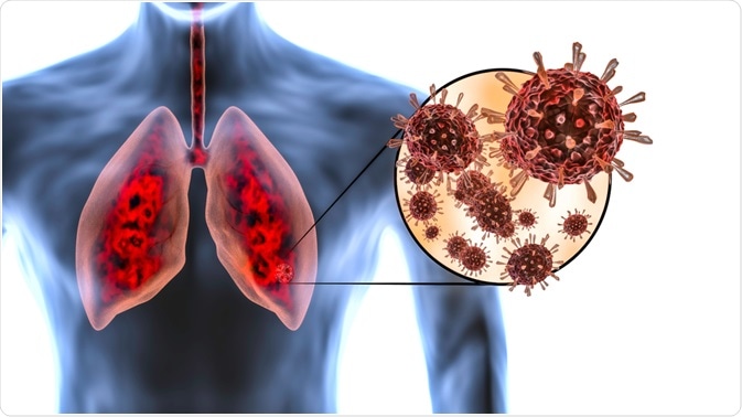 coronavirus