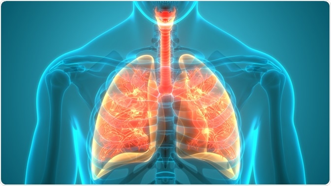 sarcoidosis