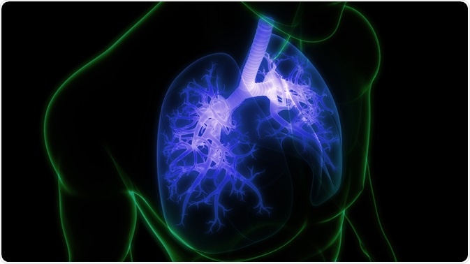 sarcoidosis