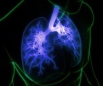Sarcoidosis Diagnosis