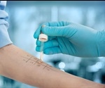 Types of Allergy Tests
