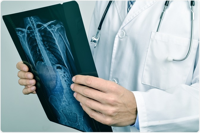 xray