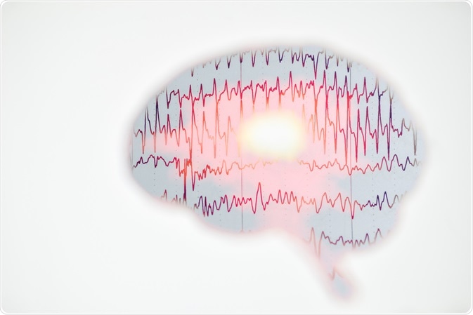 eeg