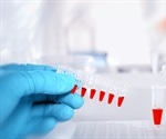 Development of Biomarkers and Biotherapeutics is Heavily Reliant on Analytical Science