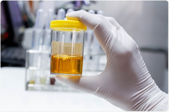 urine sample