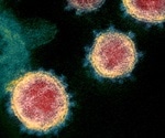 Researchers develop assay for qualitative assessment of SARS-CoV-2 neutralizing antibodies