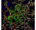 Multiplex Immunohistochemistry: An Introduction
