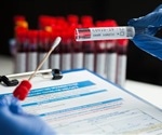 Sample Preparation for COVID-19 Testing with the Multi Reax Vortexer