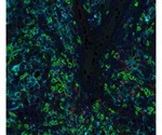Tyramide Signal Amplification: How Does It Affect Multiplex Immunohistochemistry?