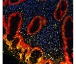 An Emerging Cancer Target and Epigenetic Regulator: BRD4